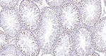 BCLAF1 Antibody in Immunohistochemistry (Paraffin) (IHC (P))