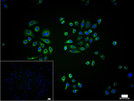 KLC3 Recombinant Rabbit Monoclonal Antibody (11C6)
