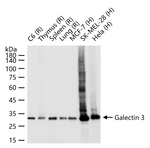 Galectin 3 Recombinant Rabbit Monoclonal Antibody (15E7)