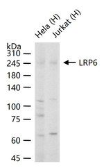 LRP6 Recombinant Rabbit Monoclonal Antibody (5D10)