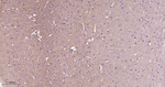 LRRK2 Antibody in Immunohistochemistry (Paraffin) (IHC (P))