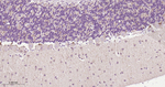 LRRK2 Antibody in Immunohistochemistry (Paraffin) (IHC (P))