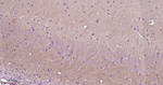 LRRK2 Antibody in Immunohistochemistry (Paraffin) (IHC (P))
