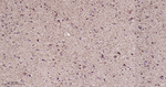 LRRK2 Recombinant Rabbit Monoclonal Antibody (12D4)
