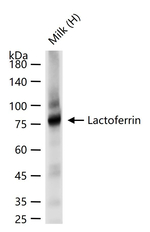 Lactoferrin Recombinant Rabbit Monoclonal Antibody (8E16)
