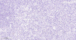 c-MAF Antibody in Immunohistochemistry (Paraffin) (IHC (P))