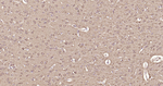LC3A Antibody in Immunohistochemistry (Paraffin) (IHC (P))