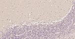 LC3A Antibody in Immunohistochemistry (Paraffin) (IHC (P))