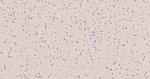 LC3A Antibody in Immunohistochemistry (Paraffin) (IHC (P))