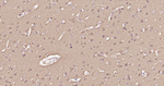 LC3A Antibody in Immunohistochemistry (Paraffin) (IHC (P))