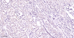 Phospho-MEK1 (Thr292) Antibody in Immunohistochemistry (Paraffin) (IHC (P))