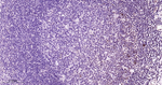 Phospho-MEK1 (Thr292) Antibody in Immunohistochemistry (Paraffin) (IHC (P))