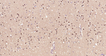 JNK1/JNK3 Antibody in Immunohistochemistry (Paraffin) (IHC (P))