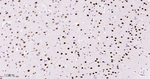 MEF2A/MEF2C Antibody in Immunohistochemistry (Paraffin) (IHC (P))