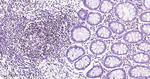 MEF2A/MEF2C Recombinant Rabbit Monoclonal Antibody (5H4)