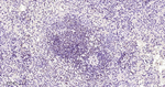 MEF2A/MEF2C Antibody in Immunohistochemistry (Paraffin) (IHC (P))