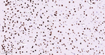 MEF2C Antibody in Immunohistochemistry (Paraffin) (IHC (P))