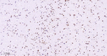 MEF2C Antibody in Immunohistochemistry (Paraffin) (IHC (P))