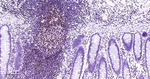 MEF2C Antibody in Immunohistochemistry (Paraffin) (IHC (P))