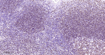 MEF2C Antibody in Immunohistochemistry (Paraffin) (IHC (P))