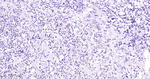 MEF2C Recombinant Rabbit Monoclonal Antibody (10D12)