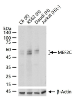 MEF2C Antibody in Western Blot (WB)