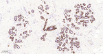 CD10 Antibody in Immunohistochemistry (Paraffin) (IHC (P))