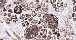 CD10 Antibody in Immunohistochemistry (Paraffin) (IHC (P))