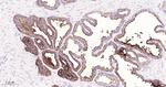CD10 Recombinant Rabbit Monoclonal Antibody (6E16)