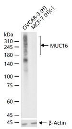 CA125 Recombinant Rabbit Monoclonal Antibody (4F9)