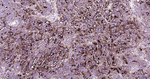 CA125 Recombinant Rabbit Monoclonal Antibody (7F8)