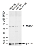 MYOD Recombinant Rabbit Monoclonal Antibody (17F1)