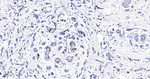 Phospho-Nucleolin (Thr84) Antibody in Immunohistochemistry (Paraffin) (IHC (P))