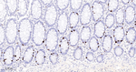 Phospho-Nucleolin (Thr84) Antibody in Immunohistochemistry (Paraffin) (IHC (P))