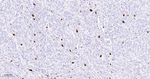 Phospho-Nucleolin (Thr84) Recombinant Rabbit Monoclonal Antibody (7F8)