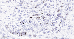 Phospho-Nucleolin (Thr76) Antibody in Immunohistochemistry (Paraffin) (IHC (P))