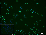 Nucleolin Recombinant Rabbit Monoclonal Antibody (17C16)