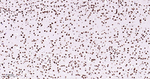 Nucleolin Antibody in Immunohistochemistry (Paraffin) (IHC (P))