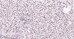 Nucleolin Antibody in Immunohistochemistry (Paraffin) (IHC (P))
