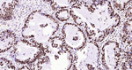 Nucleolin Antibody in Immunohistochemistry (Paraffin) (IHC (P))