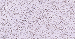 Nucleolin Antibody in Immunohistochemistry (Paraffin) (IHC (P))