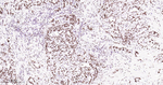 Nucleolin Antibody in Immunohistochemistry (Paraffin) (IHC (P))