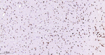Nucleolin Antibody in Immunohistochemistry (Paraffin) (IHC (P))