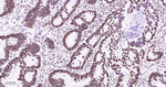 Nucleolin Antibody in Immunohistochemistry (Paraffin) (IHC (P))