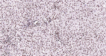 Nucleolin Antibody in Immunohistochemistry (Paraffin) (IHC (P))
