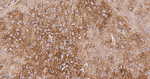 NDUFS4 Antibody in Immunohistochemistry (Paraffin) (IHC (P))