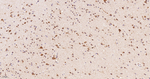 NDUFS4 Recombinant Rabbit Monoclonal Antibody (6G12)