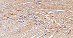 NDUFS4 Antibody in Immunohistochemistry (Paraffin) (IHC (P))