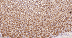 NDUFS4 Antibody in Immunohistochemistry (Paraffin) (IHC (P))