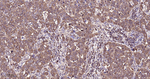 NME1/NME2 Antibody in Immunohistochemistry (Paraffin) (IHC (P))